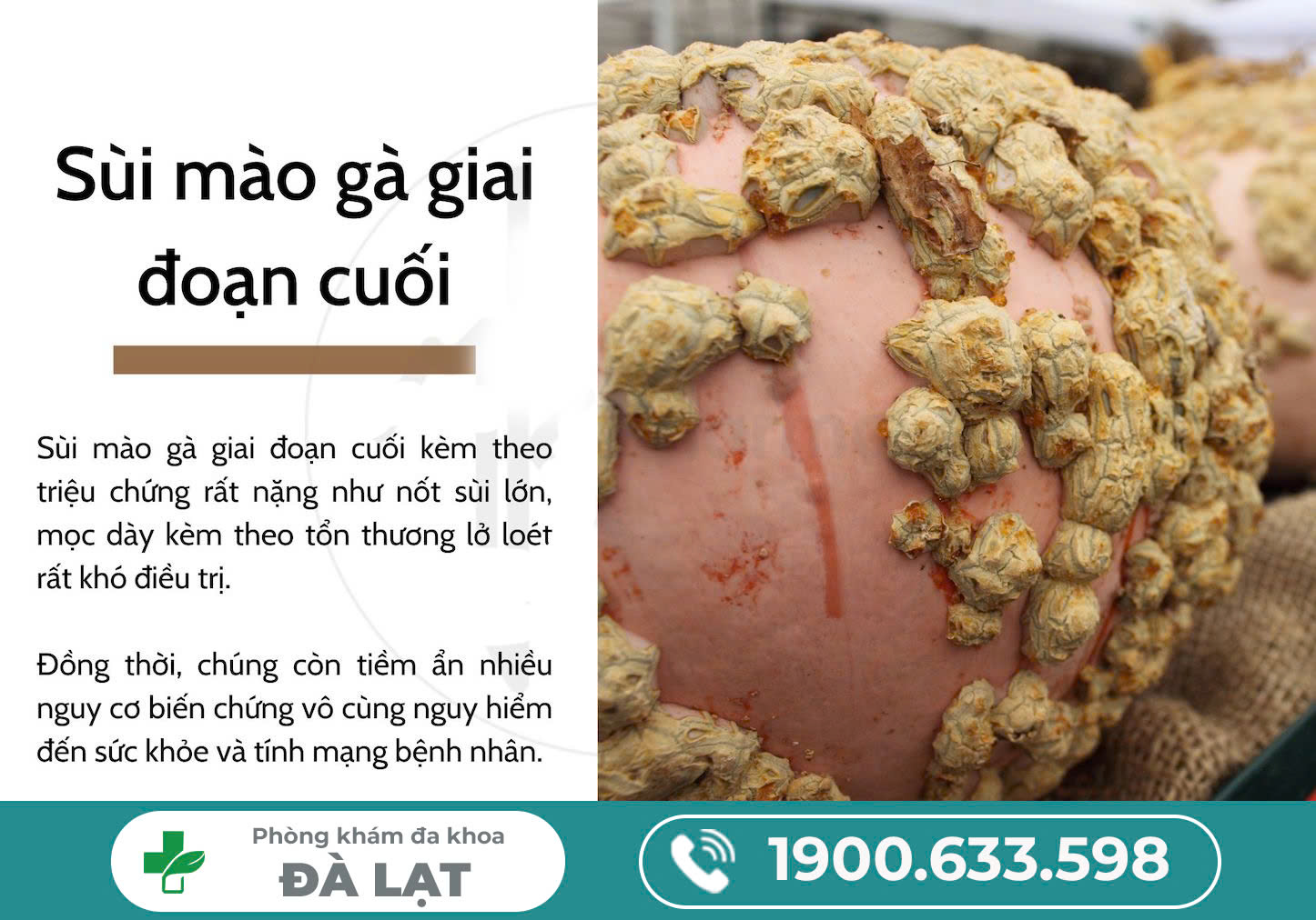 Hình ảnh minh họa